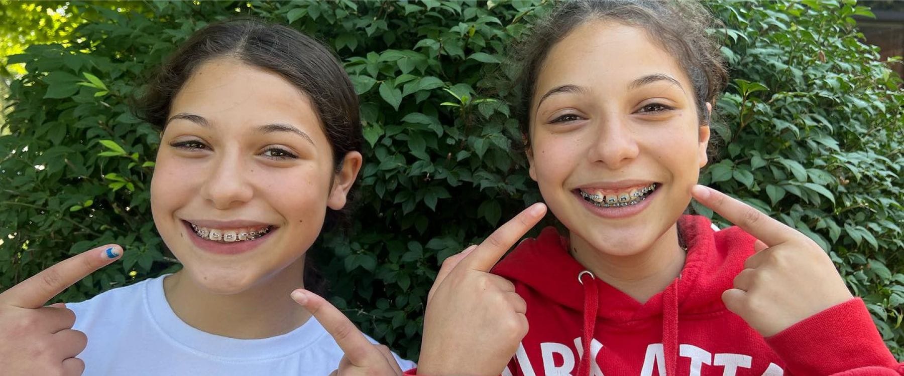 Two girls smiling pointing at their braces