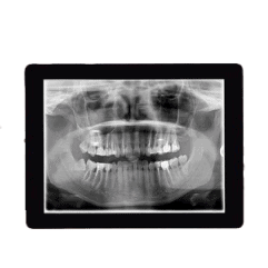 digital x-rays